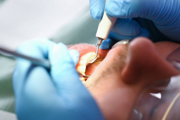 Best Emergency Root Canal Treatment in Luxora, AR